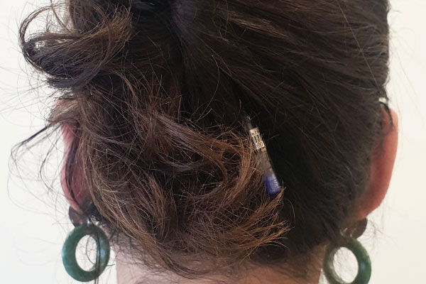 Caso de lifting facial depois